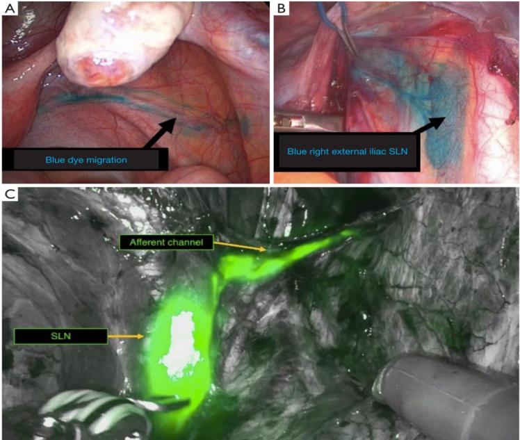 不同類型的海報(bào)

AI 生成的內(nèi)容可能不正確。